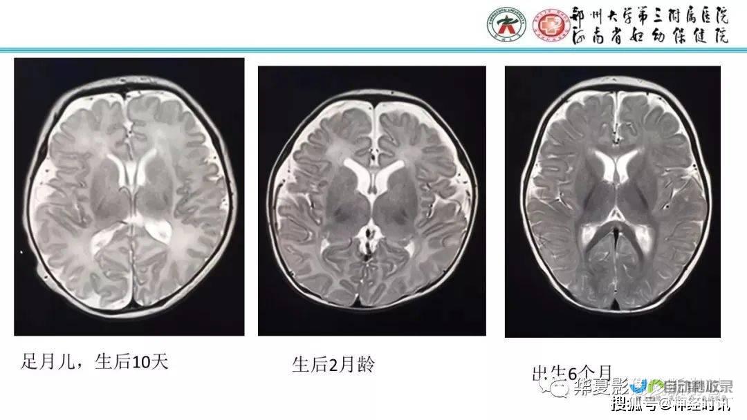 分隔呈现