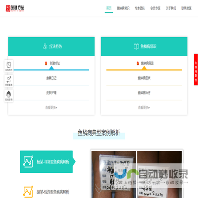 鱼鳞病治疗医院